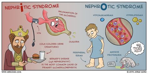 Nephritic vs. Nephrotic Syndrome — Medcomic Nephritic Syndrome, Nephrotic Syndrome, Medical Tips, Medical Mnemonics, Nursing Study Guide, Nursing Mnemonics, Teaching College, Nursing School Survival, Best Nursing Schools