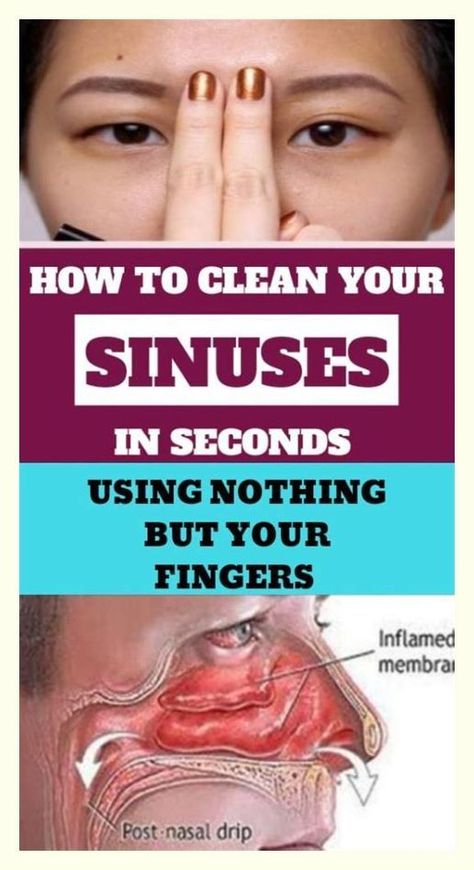 How to Clear Your Sinuses in Seconds Using Nothing but Your Fingers Clear Your Sinuses, Blocked Sinuses, Lymph Drainage Massage, How To Clear Sinuses, Cold Or Allergies, Lymph Fluid, Lymph Drainage, Sinus Pressure, Fluid Retention