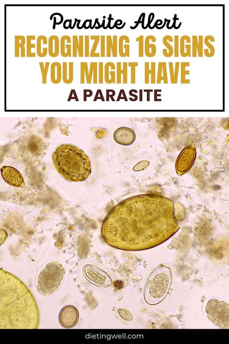 How To Flush Out Parasites, Signs Of Parasites In Humans, Symptoms Of Parasites In Humans, Parasites In Humans, Parasite Pictures, Parasites Symptoms, Parasite Cleanse, Natural Healing, Belly Fat