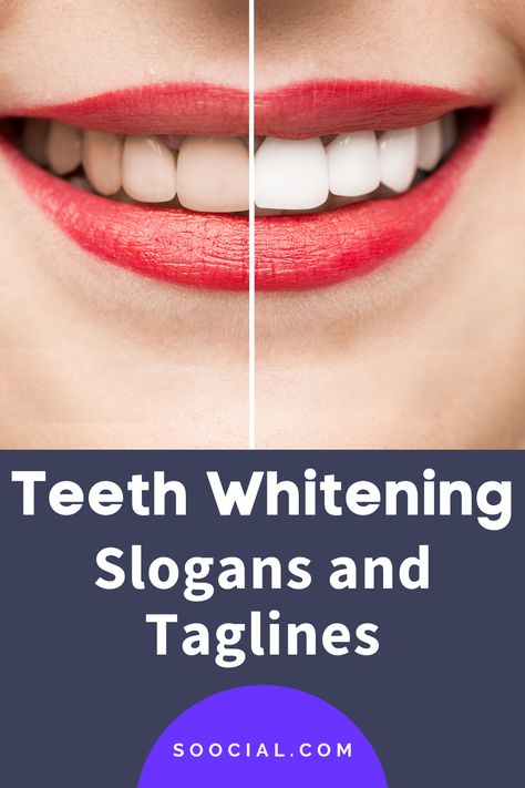 Teeth Whitening Business, Support Small Business Quotes, Small Business Quotes, Catchy Slogans, Great Ads, Stained Teeth, Teeth Care, Gift Quotes, Ads Creative