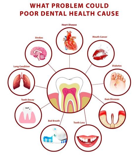 Dental Pictures, Dental Advertising, Dental Images, Dental Posts, Dental Posters, Dental Videos, Dental Fun, Dental Facts, Health Poster