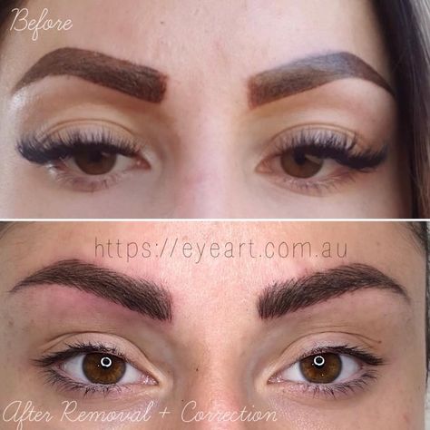 Eyebrow Microblading tattoo removal and correction repair - Eye Art Studio Bad Microblading, Tattoo Correction, Faded Eyebrows, Eyebrow Feathering, Eyebrow Tattoo Removal, Tattoos Gone Wrong, Eyebrows Tattoo, Eyebrow Microblading, Dark Brows