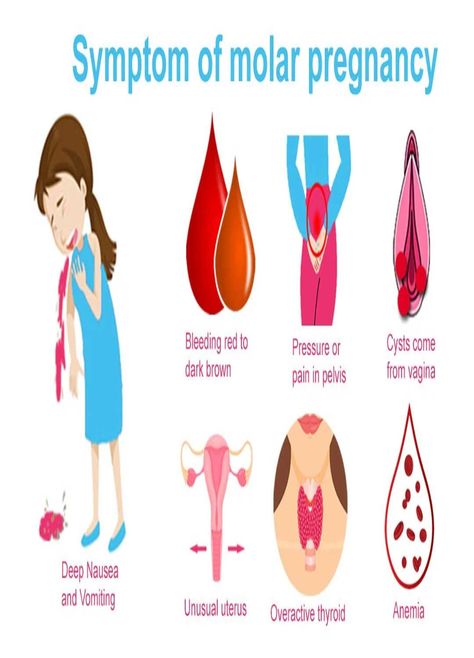 Heavy implantation bleeding pictures infographic Ultrasound Technician School, Molar Pregnancy, During Period, Overactive Thyroid, Ultrasound Technician, Medical Wallpaper, Teen Pregnancy, Pregnancy Signs, Medical Knowledge