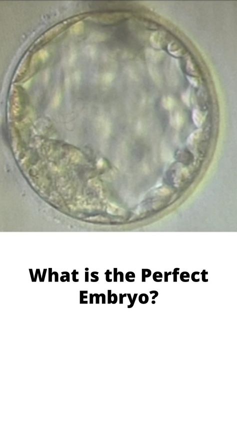 What is the Perfect Embryo? 4aa Embryo, Embryo Loss, Frozen Embryo Transfer Timeline, After Embryo Transfer, Frozen Embryo Transfer, Thank You Baskets, Fertility Nutrition, Human Embryo, Ivf Pregnancy