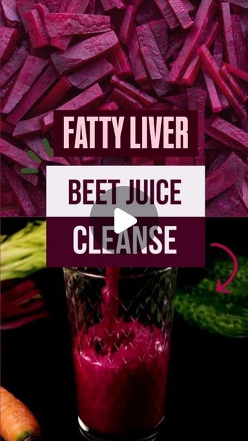 @__nutrix.healthyme on Instagram: "Fatty Liver Detox Drink: Beetroot, Celery (or Coriander), Lemon, Water!

+ Turmeric, Ginger 🍋🌿
Enhance your liver detox with these extra powerhouse ingredients:

🌿 Beetroot: Rich in betaine and nitrates, it boosts glutathione production and detoxes enzymes to break down toxins like alcohol and heavy metals.
🥬 Celery (or Coriander): Reduces inflammation, supports bile production, and aids fat digestion.
🍋 Lemon: High in vitamin C, it promotes the conversion of toxins into water-soluble compounds for easy excretion.
🧂 Turmeric: With curcumin, reduces inflammation and promotes liver detox.
🫚 Ginger: Aids digestion and supports bile flow for breaking down fats.

Drink this blend for 10 days to maximize liver detoxification, reduce liver fat, and protec Liver Detox Drink, Liver Cleanser, Liver Detoxification, Beet Juice, Liver Detox, Juice Cleanse, Detox Water, Lemon Water, Heavy Metals