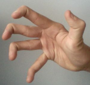 What is Hypermobility?... Hypermobility is a joint condition in which the joints move beyond the normal range expected.   Click here to learn about How Weight Training Helps Hypermobility:  http://wp.me/p2hs4t-f5 Double Jointed Fingers, Double Jointed, Ehlers Danlos, Ehlers Danlos Syndrome, Healthy Shopping, Fitness Blog, Hand Holding, Intp, Weight Training