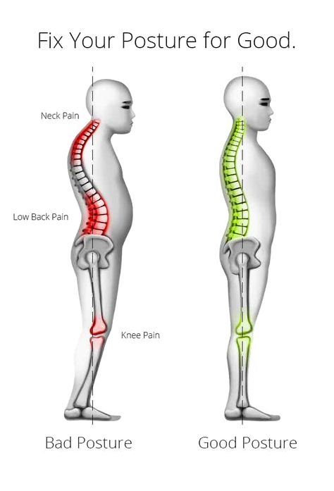 Fix Posture, Posture Drawing, Shoulder Mobility Exercises, Sleeping Posture, Better Posture Exercises, Body Gestures, Fix Your Posture, Forward Head Posture, Rounded Shoulders