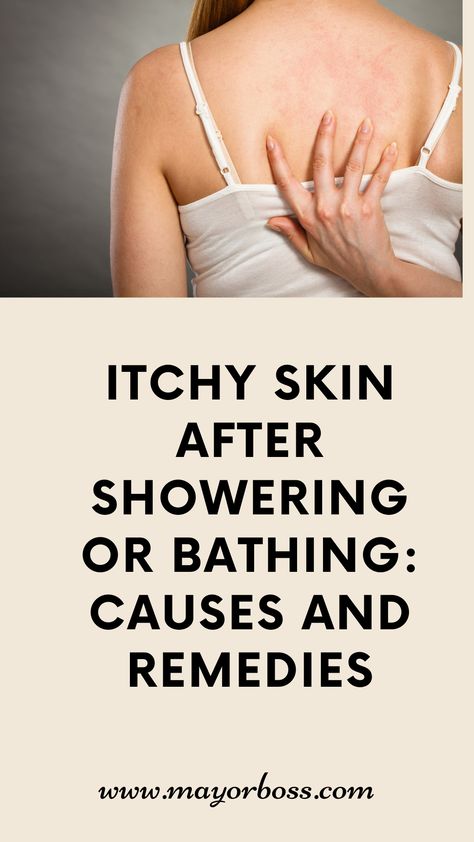 See the common causes of itchy skin after showering or bathing, and find effective remedies to alleviate the discomfort. From dry skin to allergies, learn about the triggers and solutions to restore your skin's comfort. Itching Skin Remedies, Dry Itchy Skin Remedies, Skin Rash Remedies, Itching Remedies, Itchy Body, Itchy Skin Remedy, Remedies For Dry Mouth, Rashes Remedies, Home Remedies For Warts