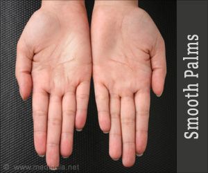 Smoothen Those Rough Palms How To Soften Hands, Hand Scrub Diy, Natural Nail Shapes, Home Remedies For Wrinkles, Coffee Face Mask, Rough Hands, Hand Scrub, Summer Glow, Skin Care Remedies