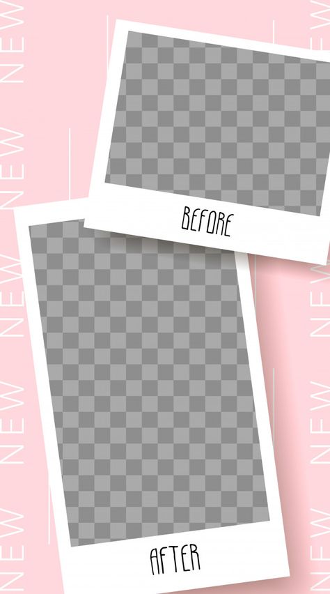 Before And After Background Template, Before And After Nails Background, Before And After Story Template, Before And After Template Instagram, Before And After Layout Design, Before And After Aesthetic Template, Before After Story Instagram, Before After Background, Before And After Design Template