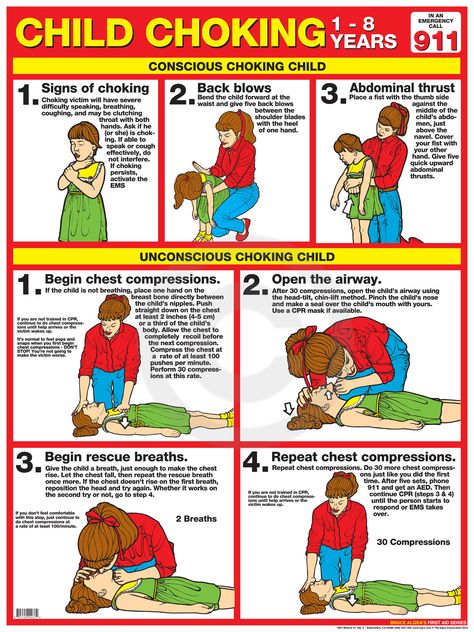 First Aid Choking Child First Aid Poster, Infant Cpr, First Aid Cpr, First Aid Tips, Emergency First Aid, Survival Life, Medical Knowledge, Medical Education, Child Safety