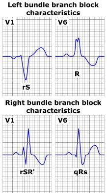 Emt Instructor, Ekg Reading, Telemetry Technician, Cath Lab Nursing, Ekg Rhythms, Cardiac Rehab, Emt Study, Bundle Branch Block, Medical Terminology Study