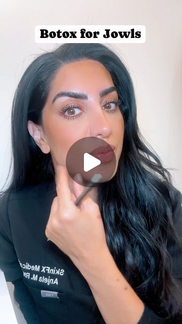 Skinfx Medical Spa on Instagram: "Injecting Botox into the platysmal bands located in the neck along the jawline can release the downward pull of lower face. This can help with a slight improvement of mild jowls and a slight lift of the lower face. Like & save for future references🖤" Platysmal Bands, Lower Face Lift, Abdominal Pain Relief, Botox Before And After, Botox Face, Skin Facts, Hair Upstyles, Neck Lift, Botox Fillers