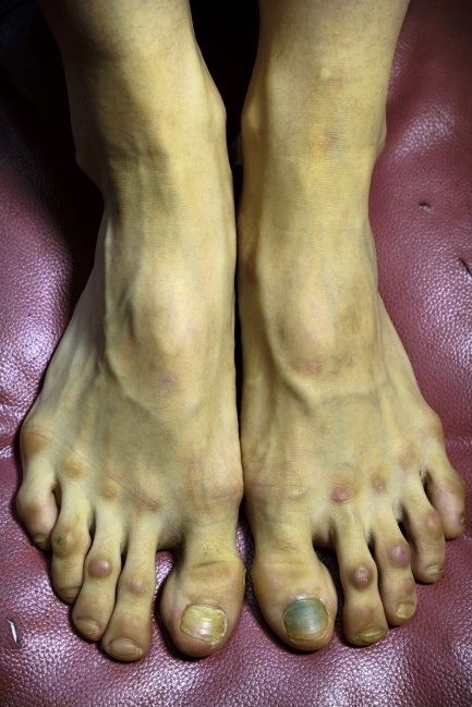 The feet of a female ballet dancer. Ballet Essentials, Famous Ballerinas, Ballet Positions, Ballet Performance, Medical Photography, Bible Teaching, Glass Slippers, Working Women, Funny Work