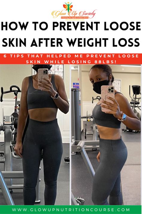 6 ways to prevent loose skin after weight loss Prevent Loose Skin, Extra Skin, Excess Skin, Loose Skin, Lose 50 Pounds, Lose Belly, Plastic Surgery, Lose Belly Fat, Surgery