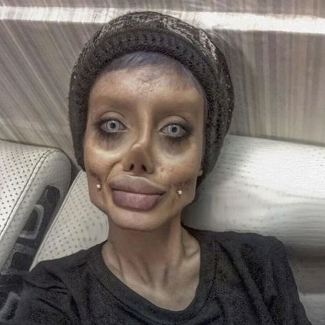 Sharon Osbourne has been vocal about her various cosmetic procedures over the years, and now the TalkTV host is putting a stop to surgeries Sahar Tabar, Bad Plastic Surgeries, Plastic Surgery Gone Wrong, Sharon Osbourne, Under The Knife, Iranian Women, Cosmetic Procedures, Gone Wrong, Corpse Bride