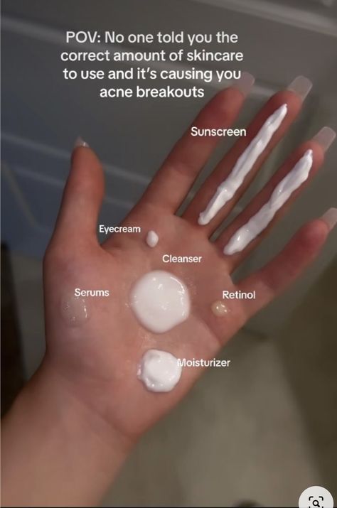 Acne Map, Acne Chart, Acne Face Map, Face Map, Back Acne Remedies, Selfcare Products, Face Mapping Acne, Forehead Acne, Fungal Acne