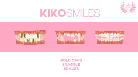 Kiko Smiles: Realistic Teeth (Gold Caps, Snaggle & Braces)🦷 Sims 4 Nails, The Sims 4 Skin, Sims 4 Family, My Sims, Free Sims 4, Sims 4 Game Mods, Sims 4 Cc Makeup, Sims 4 Body Mods, Sims 4 Expansions