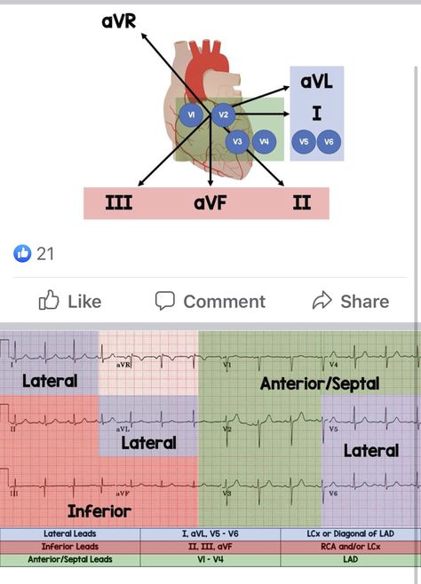 12 Lead Ekg Interpretation Cheat Sheets, Cardiac Cath Lab Nurse, Cath Lab Nursing, Medical Assistant Student, Paramedic School, Nursing Information, Nursing School Essential, Medical School Life, Nursing School Motivation