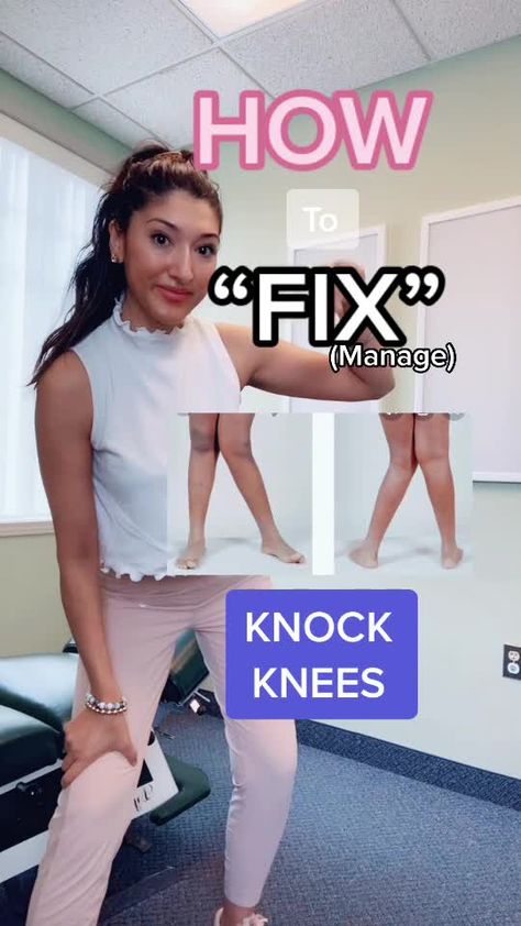 #greenscreensticker #howtofix #knockknee #kneepain #glutesworkout #chiropractic #chiro #torontochiro #toronto #hamilton #crackingbones Knocked Knees, Knock Knees, Knee Pain, Glutes Workout, Chiropractic, Knock Knock, Make Your Day, Toronto, Get Started