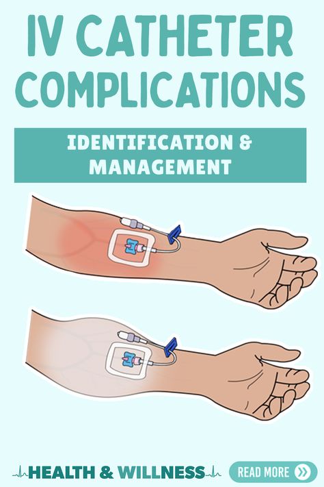 Iv Insertion, Iv Administration, Intravenous Therapy, Nursing School Essential, Medical School Life, Vascular Surgery, Nurse Study Notes, Infection Prevention, Nursing School Notes