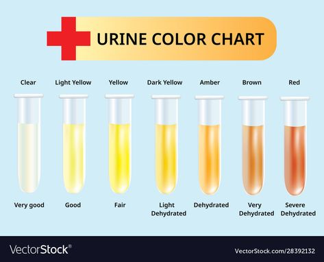 Urine Color Chart, Pee Color, Color Of Urine, Urine Color, Medical Vector, Bicycle Quotes, Test Tubes, Rustic Colors, Medical Illustration