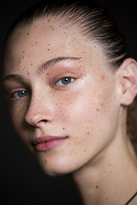 Freck Yourself Offers Faux Freckles To Those Who Dream Of Dotted Skin — PHOTOS Moles On Face, Skin Moles, Beautiful Freckles, Faux Freckles, Freckle Face, Skin Photo, Beauty Mark, Pretty Skin, Portrait Ideas