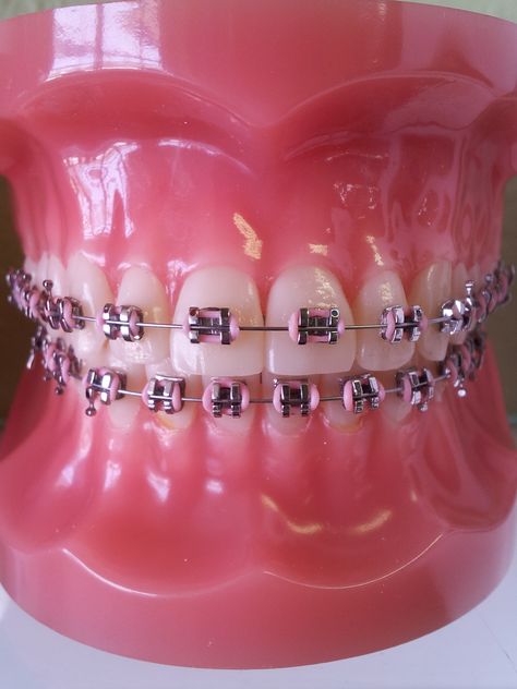 Braces Color Combos, Power Chain Braces, Dental Braces Colors, Braces Colors Combinations, Pink Braces, Braces Retainer, Jewelry Teeth, Braces Colors Ideas, Teeth Gems