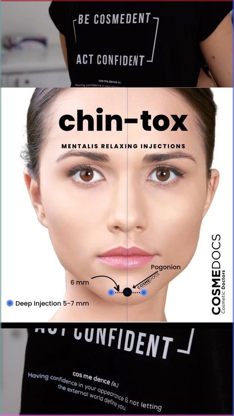 Treating mentalis muscle with #Botox to alleviate #chin #wrinkles and improve #facial #symmetry. As a doctor, I understand the importance of addressing both physical and mental well-being. #BeautyInsideOut #CosmeticMedicine #Aesthetics #MentalisTreatment #harleystreet #mayfairlondon #beautytips101 Chin Wrinkles, Facial Symmetry, V Shape Face, Chin Implant, Botox Before And After, Anti Wrinkle Injections, Muscle Anatomy, Face Facial, Heart Face Shape