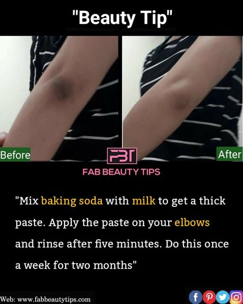 Baking soda has both exfoliating and skin lightening properties that may help treat dark elbows. Start by adding a teaspoon at a time of milk to a bowl. Keep adding and mixing well until you have the desired amount of product. Then, apply directly to your elbows. Dark Elbows, Beginner Skin Care Routine, Face Skin Care Routine, Natural Skin Care Remedies, Diy Skin Care Routine, Natural Face Skin Care, Good Skin Tips, Skin Care Face Mask, Basic Skin Care Routine