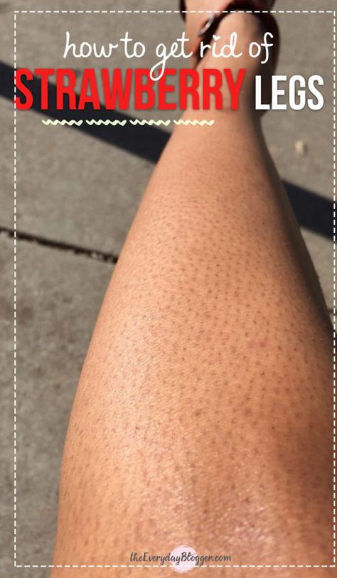 How to Get Rid of Strawberry Legs Coffee Facial, Strawberry Legs, Helpful Advice, Glowing Radiant Skin, Skincare Selfcare, Skincare Secrets, Smooth Legs, Home Remedies For Hair, Luscious Hair