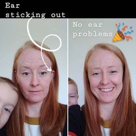 This super simple tip will blow your mind and a bonus is that your ears will not be sticking out anymore!!! Hairstyles For Ears That Stick Out, Ears That Stick Out, Face Framing Hair, Hair Falling, Quick Hairstyle, Hair Tuck, Nape Of Neck, In Your Face, Ear Hair