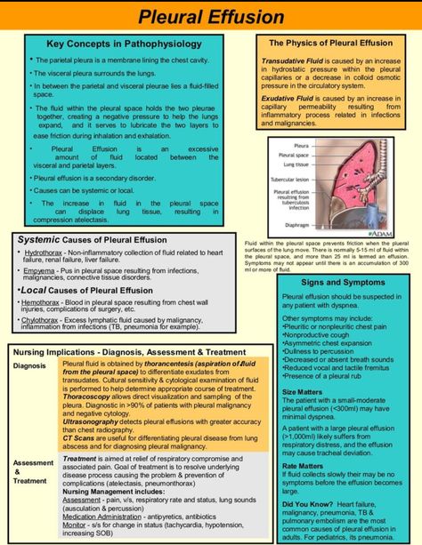 Pleural Effusion Nursing Information, Pleural Effusion, Nursing Board, Med Surg Nursing, Nursing Mnemonics, Medical Surgical Nursing, Pulmonology, Cardiac Nursing, Nursing School Survival