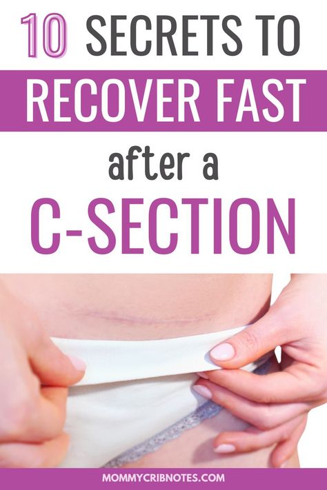 c-sections, c-section tips, c-section secrets, c-section hacks, c-section essentials, c-section scars, c-section recovery, postpartum recovery, postpartum tips, postpartum hacks, postpartum essentials, first time moms, c section, c section tips, c section secrets, c section hacks, c section essentials, c section scars, c section recovery, new mom tips Post C Section Recovery Foods, Post Delivery Care, Postpartum Essentials C Section, C Section Scar Healing, Postpartum C Section Recovery, C Section Post Partum Essentials, Csection Postpartum Care, C-section, Post C Section Recovery