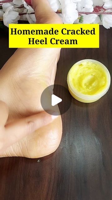 Diy Cracked Heel Remedy, How To Heal Cracked Heels, Cracked Heel Remedy, Cracked Heels Diy, Cracked Feet Remedies, Soften Heels, Cracked Heel Remedies, Heal Cracked Heels, Diy Body Scrub Recipes