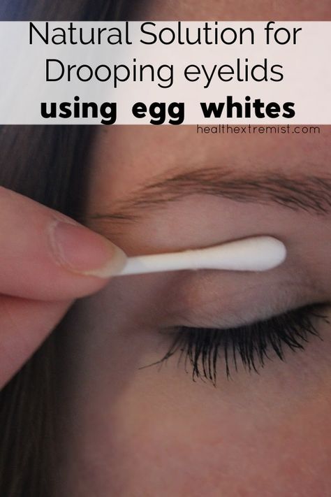 Natural Remedy For Drooping Eyelids, Sagging Eyelids or Hooded Eyes Saggy Eyelids, Sagging Eyelids, Drooping Eyelids, Hooded Eyelids, Droopy Eyelids, Droopy Eyes, Natural Healing Remedies, Diy Remedies, Leaky Gut