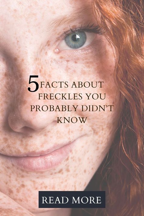 5 Facts About Freckles You Probably Didn’t Know Makeup Ideas Freckles, Freckled Skin Makeup, How To Enhance Freckles Naturally, Freckles On Tan Skin, Makeup For Girls With Freckles, How To Make Your Freckles Pop, Freckles Skin Care, Tattoos Over Freckles, Hair For Freckled Skin