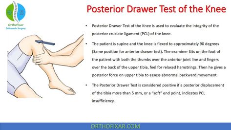 Physical Therapy School, Physical Therapy Student, Knee Ligaments, Anterior Cruciate Ligament, Physical Therapy Assistant, Ligament Tear, Cruciate Ligament, Ligament Injury, Musculoskeletal System