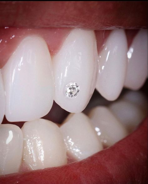 Real diamond drilled in canine tooth #toothdiamond #toothjewelry #toothgems #teeth #veneers Diamond In Tooth, Tooth Gems On Canines, Gem On Tooth, Tooth Gem Canine, Diamond On Tooth, Canine Tooth Gem, Single Tooth Gem, Diamond On Teeth, Diamond Teeth Jewelry