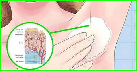 Detox Your Armpits, Odor Remedies, Smelly Armpits, Wise Mind, Underarm Odor, Armpit Fat, Health Hacks, Sweat Gland, Diy Products