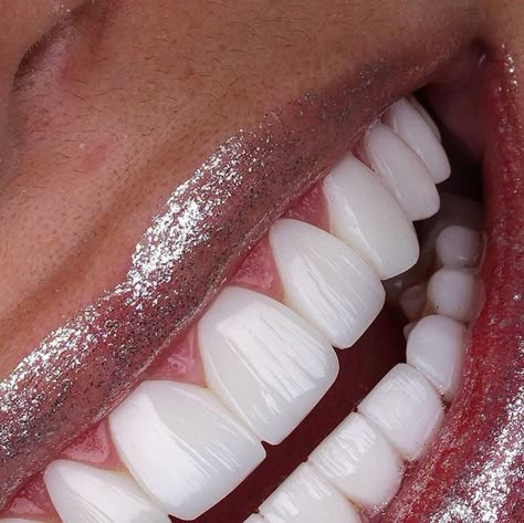 Perfect Teeth Smile, Teeth Veneers, Cosmetic Dentistry Veneers, Losing Teeth, Cosmetic Dentistry Procedures, Pretty Teeth, Veneers Teeth, Beautiful Teeth, Loose Tooth