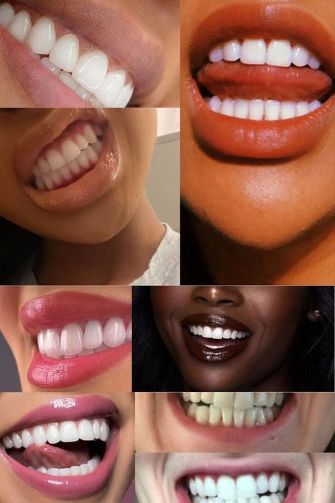 🎀 White teeth overnight | Crest 3D Whitestrips | Linked! White Teeth Overnight, Smile White Teeth, V34 Colour Corrector, Smile White, Colour Corrector, Whitening Teeth, Perfect Teeth, Yellow Teeth, White Smile