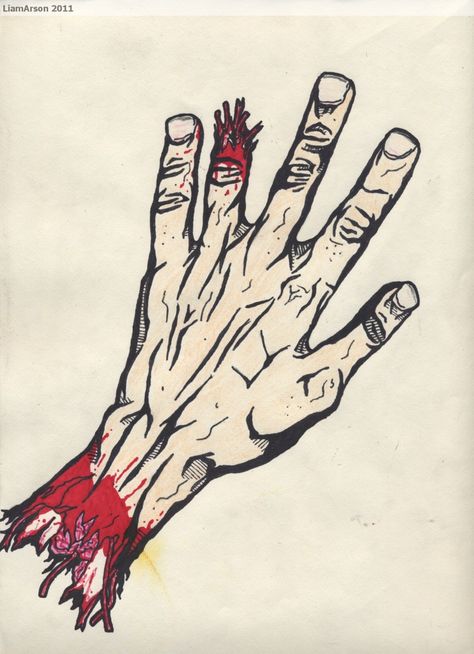 Severed Hand. By Liam Arsön. Severed Hand, Titus Andronicus, Summer Halloween, Peace Gesture, Okay Gesture, Mood Board, Halloween, Quick Saves, Art