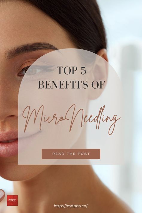 Top 5 benefits of microneedling Micro Needling Benefits, Micro Needling Before And After, Microneedling Aesthetic, Microneedling Benefits, Benefits Of Microneedling, Aesthetics Business, Energy Waves, Skin Care Center, Roller For Face