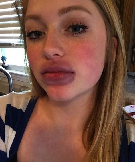 kylie jenner lip challenge Kylie Jenner Lip Challenge, Kylie Jenner Lip, Beauty Standards, Makeup Trends, Photo Dump, Kylie Jenner, Top Styles, Lips, Makeup