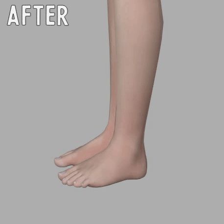 Sims 4 Feet Slider, Sims 4 Hand Slider, Sims 4 Cc Feet Default, Sims 4 Feet Replacement Cc, Sims 4 Feet Replacement, Sims Finds, Tumblr Sims 4, Sims Four, Sims4 Cc