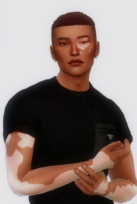 Vitilgo Sims4, Sims 4 Male Hair Buzzcut, Male Skinblend Sims 4, Sims 4 Cc Vilitigo Skin Patreon, Sims 4 Cc Maxis Match Skin Overlay Male, Sims 4 Vitíligo Cc Patreon, Sims 4 Vitíligo Skin Cc, Sims 4 Cc Male Skin Overlay Patreon, Sims 4 Cc Vitíligo Skin