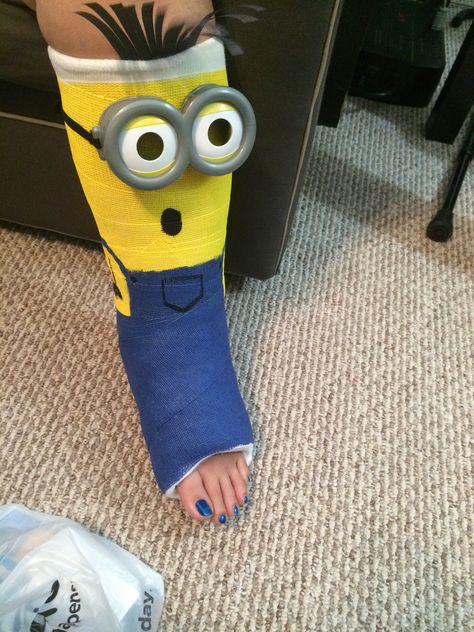 Minion leg cast design Cast Decorating Ideas Leg, Leg Cast Decorating Ideas, Cast Drawing Ideas Arm, Cast Colors, Ankle Cast, Cast Decoration, Cast Drawing, Simple Wall Paintings, Arm Cast