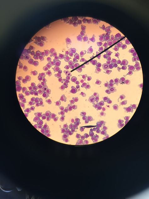 Canine lymphoma— cells undergoing abnormal mitosis Vet School, Biology, Science, Quick Saves