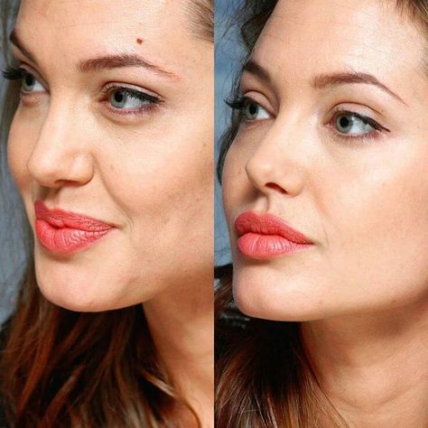 Angelina Jolie Nose Job, Angelina Jolie Nose, Angelina Jolie Plastic Surgery, Botox Before And After, Celebrities Before And After, Lip Shapes, Beauty Goals, Nose Job, Girl Celebrities